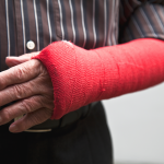 Ein Bruch im Unterarmbereich, wie bei diesem Mann, führt häufig zu erheblichen Einschränkungen.