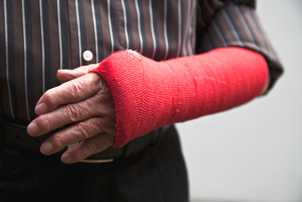 Ein Bruch im Unterarmbereich, wie bei diesem Mann, führt häufig zu erheblichen Einschränkungen.